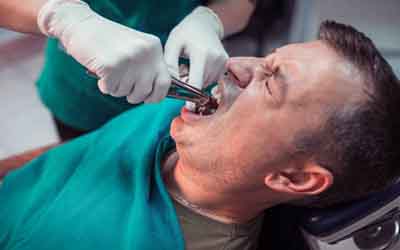 Common types of dental trauma